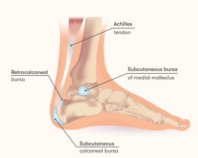 Synovitis bursitis térdízület kezelése