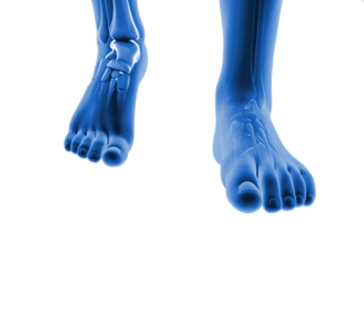Delayed Fracture Healing