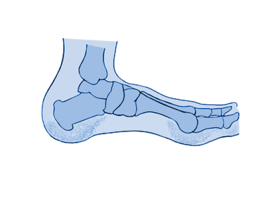 fat pad atrophy