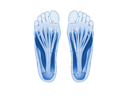 plantar fasciitis