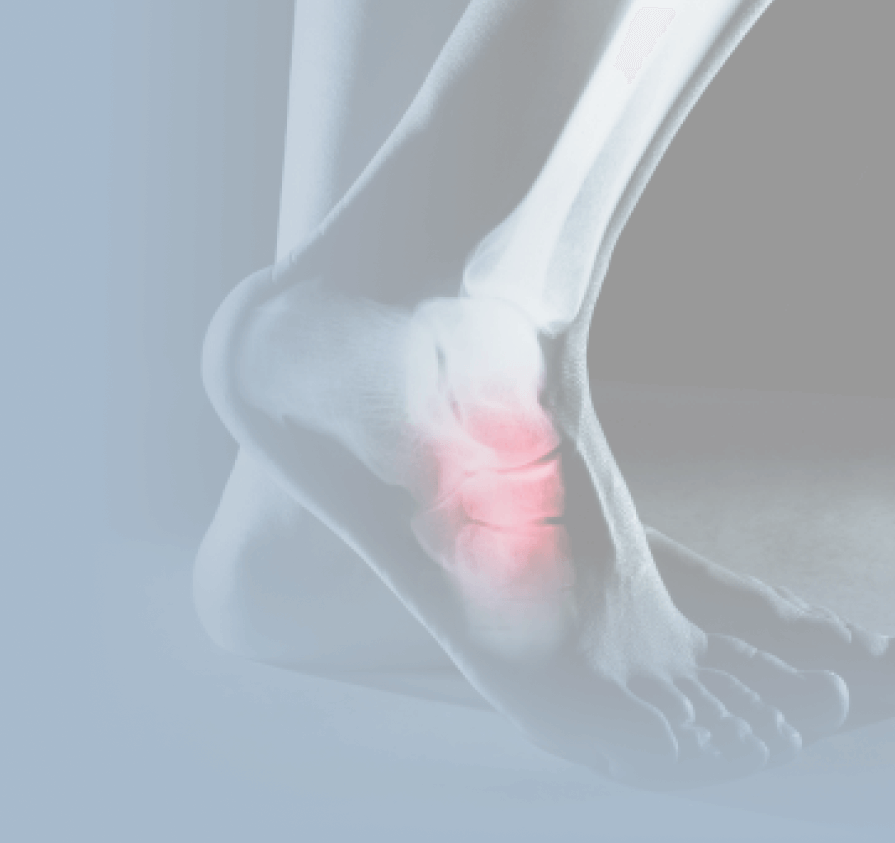 Cuboid Syndrome Treatment Boston Foot Ankle Biologics