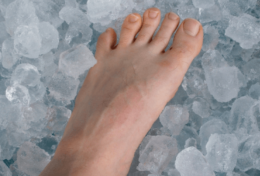 ICE MASSAGE