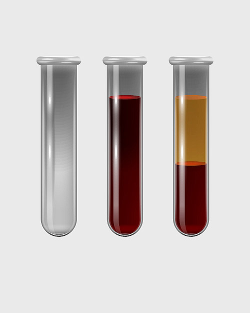 Plasma Banner
