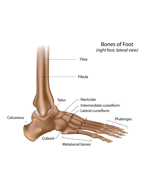 Treating Foot Fractures With Bone Stimulators