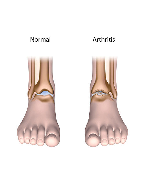 Normal Ankle